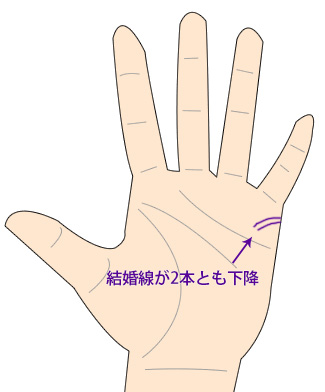 不倫手相 別れたほうがいい